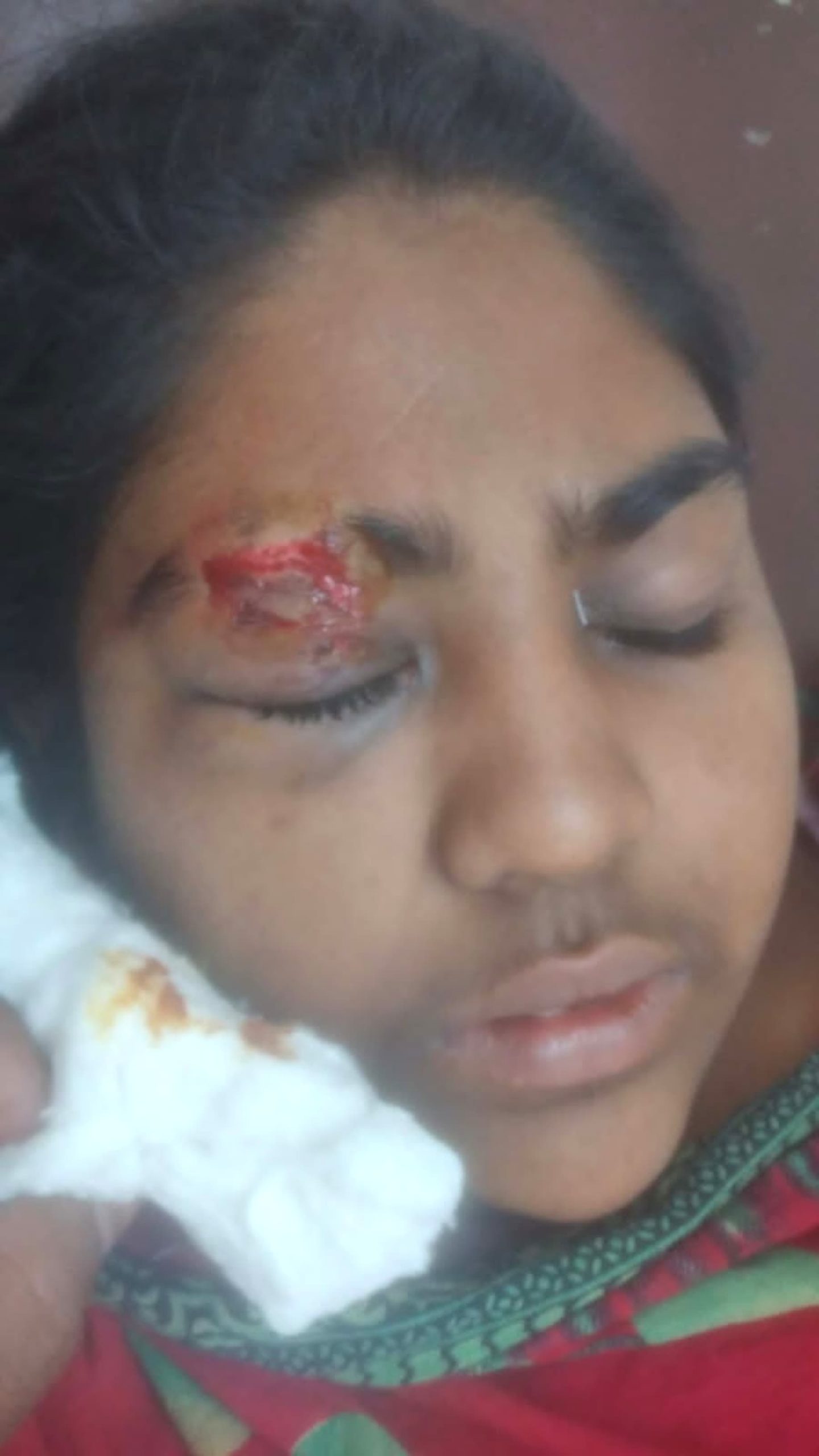 বীরগঞ্জে বাড়ি পথ অবরুদ্ধ, সংঘর্ষে নারী-শিশুসহ ৪ জন আহত