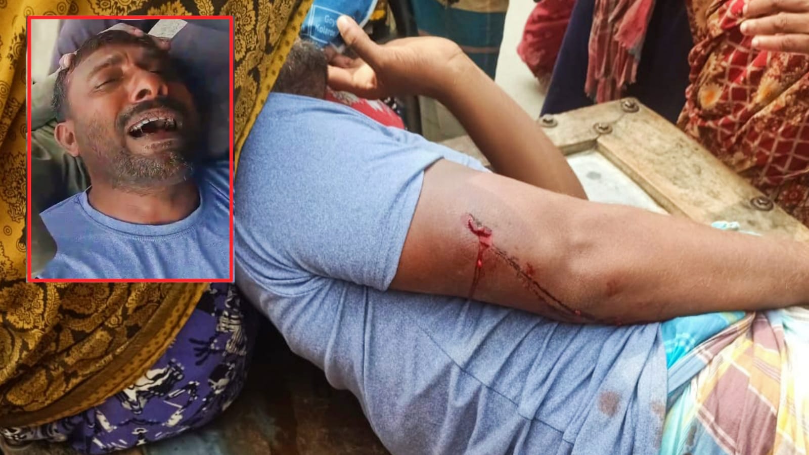 শার্শায় চাঁদার দাবিতে যুবককে হাতুড়ি দিয়ে পিটিয়ে জখম