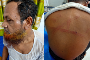 শ্যামনগরে জামায়াত নেতাকে পিটিয়ে আহত করার অভিযোগ, প্রতিবাদে বিক্ষোভ মিছিল