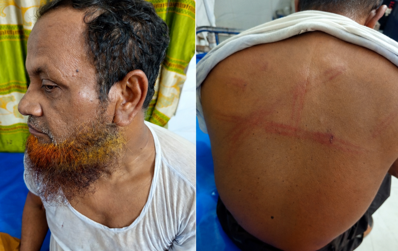 শ্যামনগরে জামায়াত নেতাকে পিটিয়ে আহত করার অভিযোগ, প্রতিবাদে বিক্ষোভ মিছিল